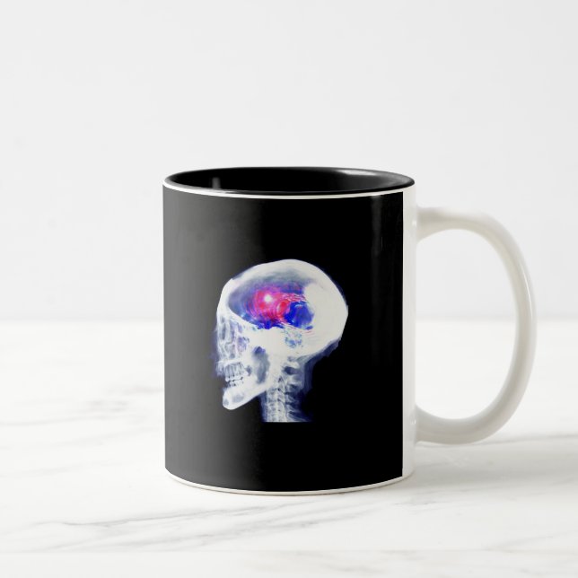 Cyborg Brain Two-Tone Coffee Mug (Right)