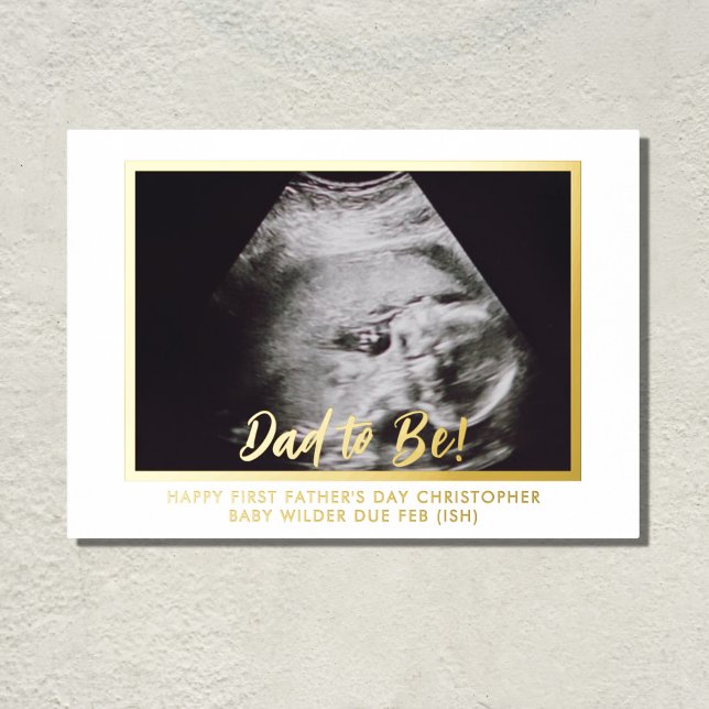 Dad to be Ultrasound Photo 1st Father's Day Foil Prints (Surprise the Dad to Be with this real foil print of your baby to be. Just add a message)