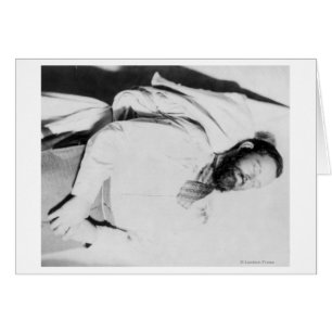 Dead Body of Outlaw Jesse James Photograph