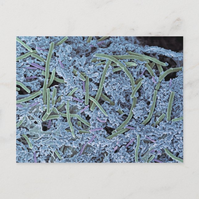 Dental plaque, coloured scanning electron postcard (Front)