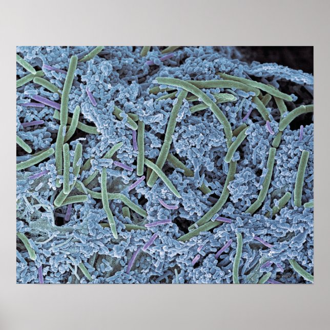 Dental plaque, coloured scanning electron poster (Front)
