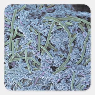 Dental plaque, coloured scanning electron square sticker