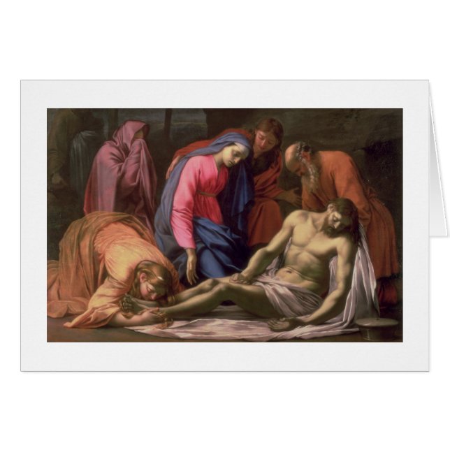 Deposition (Front Horizontal)