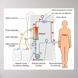 Medical Diagram Posters & Photo Prints | Zazzle AU