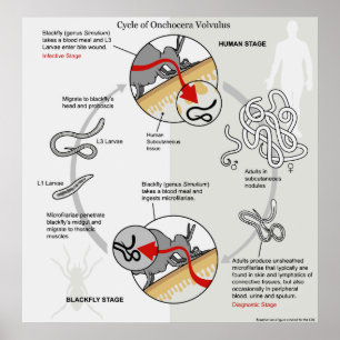 Diagram of The Life Cycle of Onchocerca Volvulus Poster