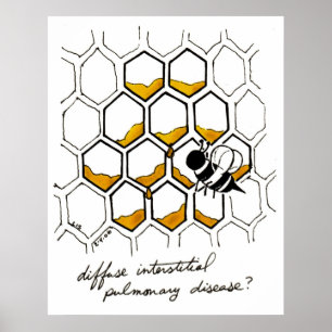 Diffuse Interstitial Pulmonary Disease Poster
