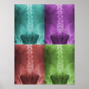 Digital X-Ray Art Canvas Poster