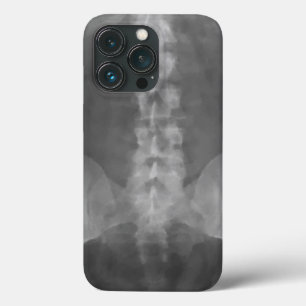 Digital X-Ray Art iPhone 13 Pro Case