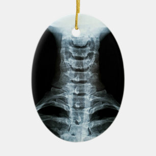 Digital X-Ray Art (Custom Back Text) Ceramic Ornament
