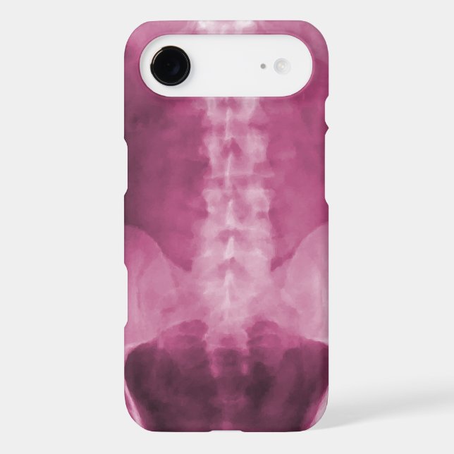 Digital X-Ray Art  iPhone 4/4s Case (Back)