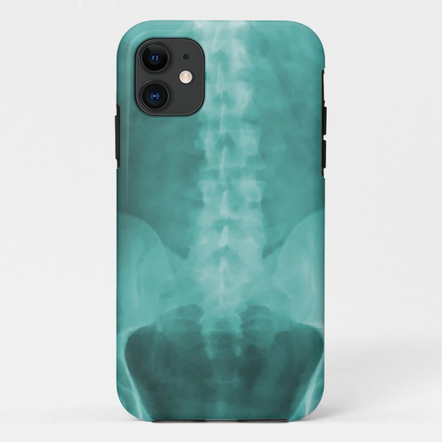 Digital X-Ray Art iPhone 5 Case (Back)