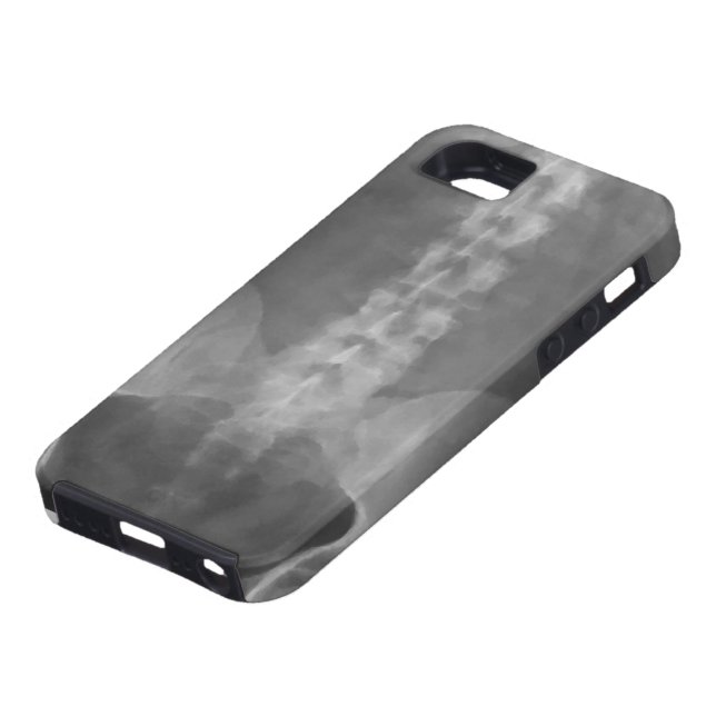 Digital X-Ray Art iPhone 5 Case (Bottom)