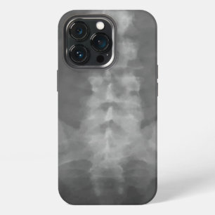 Digital X-Ray Art iPhone Case