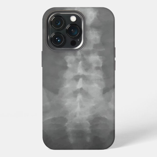 Digital X-Ray Art iPhone Case (Back)