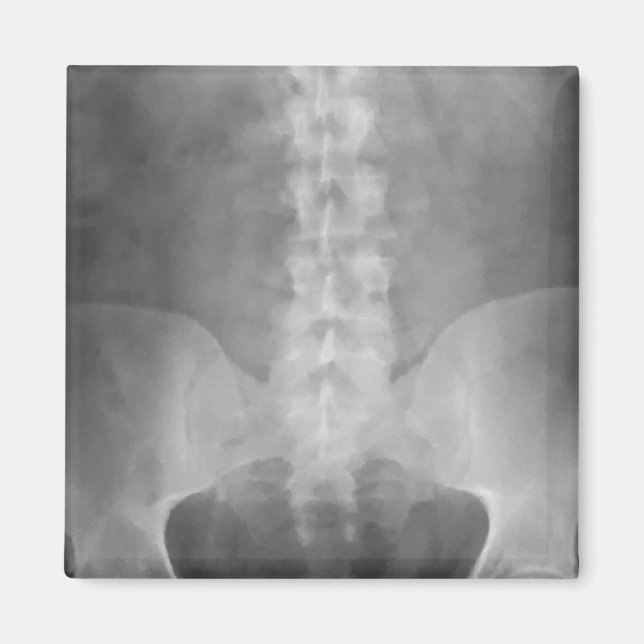Digital X-Ray Art Magnet (Front)
