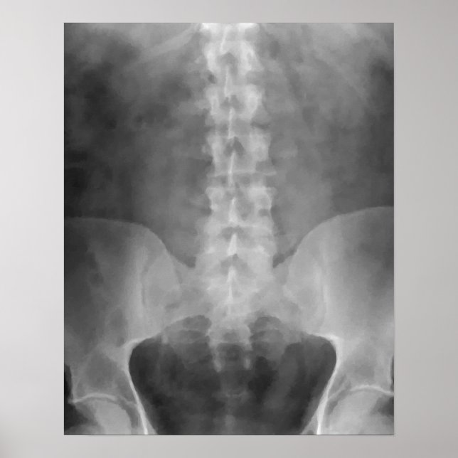 Digital X-Ray Art Print (Front)