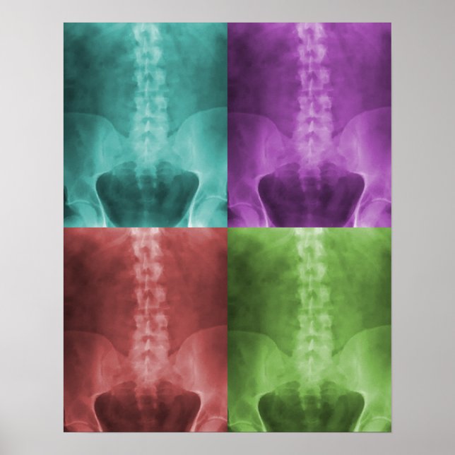 Digital X-Ray Art Print (Front)