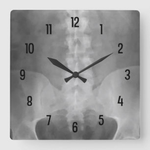 Digital X-Ray Art Wall Clock