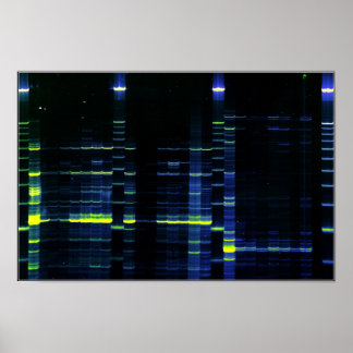 DNA Sequence gel 1 Poster