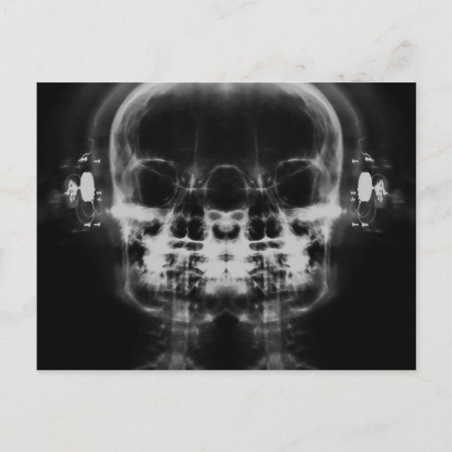 Double X-Ray Skulls with Headphones - B&W Postcard (Front)