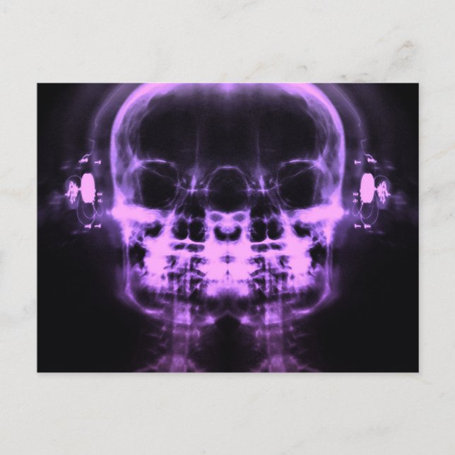 Double X-Ray Skulls with Headphones - Purple Postcard (Front)
