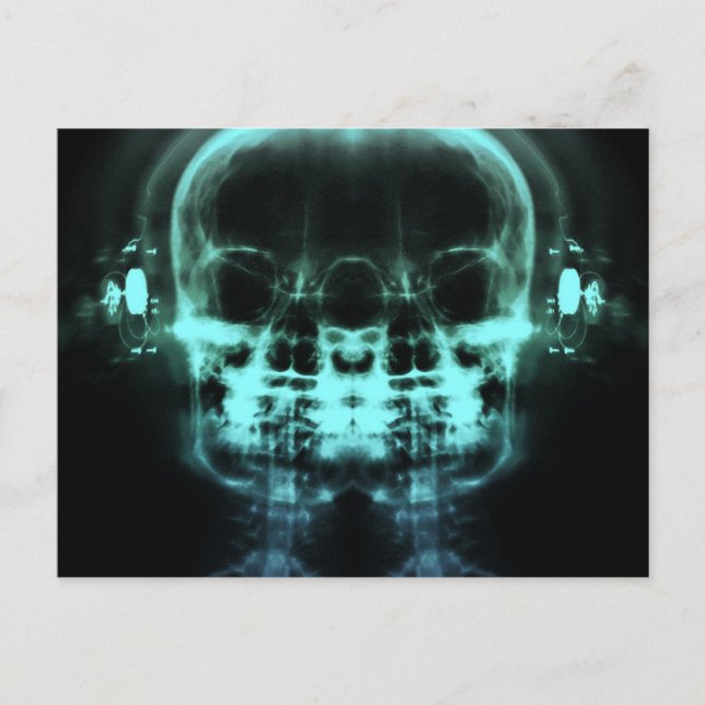 Double X-Ray Skulls with Headphones - Teal Postcard (Front)
