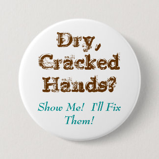 Dry,CrackedHands?, Show Me!  I'll Fix Them! 7.5 Cm Round Badge