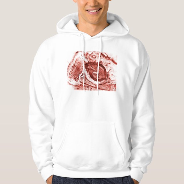 dying apart hoodie (Front)