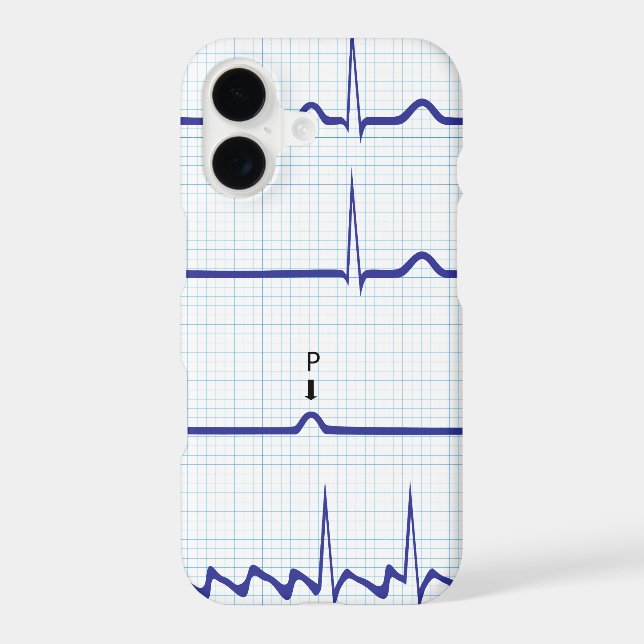 ECG/EKG iPhone case (Back)