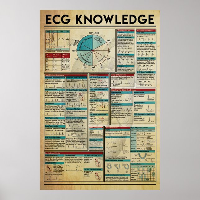 ECG Knowledge Poster, Cardiology Knowledge Poster (Front)