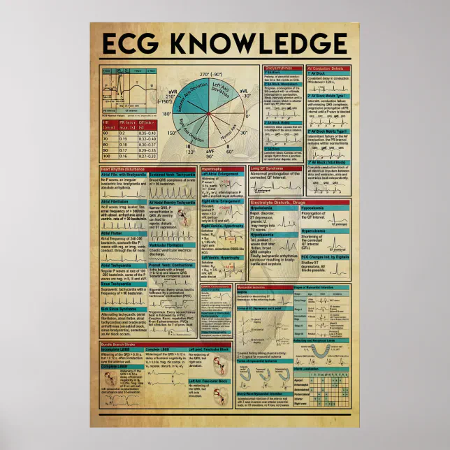 ECG Knowledge Poster, Cardiology Knowledge Poster | Zazzle