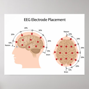 EEG electrode placement diagram Poster