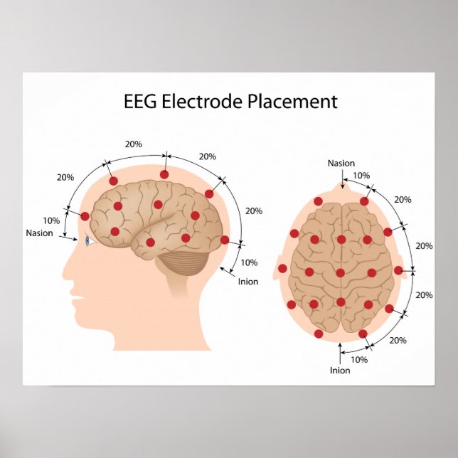 EEG electrode placement diagram Poster (Front)