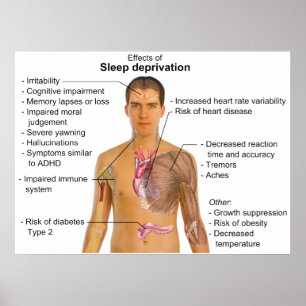 Effects of Sleep Deprivation on the Human Body Poster