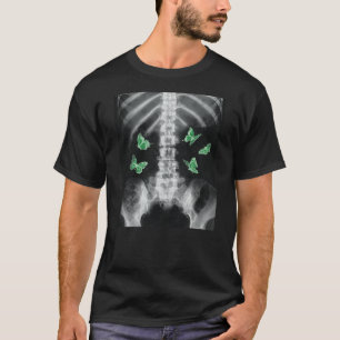 Egirl Xray Skeleton Green Butterfly Harajuku Dark T-Shirt