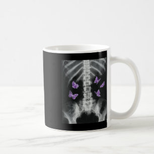 Egirl Xray Skeleton Pink Butterfly Harajuku Y2k Da Coffee Mug
