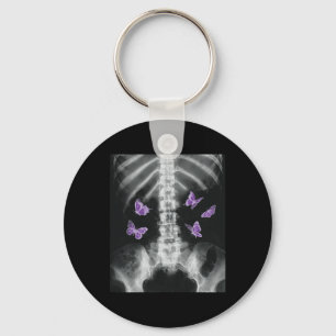 Egirl Xray Skeleton Pink Butterfly Harajuku Y2k Da Key Ring