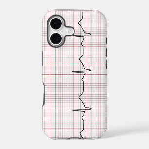 EKG heartbeat on graph paper, PhD (doctor) pulse