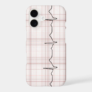 EKG heartbeat on graph paper, PhD (doctor) pulse