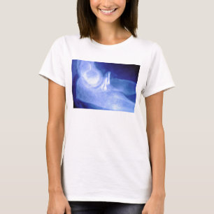 Elbow xray with screws T-Shirt