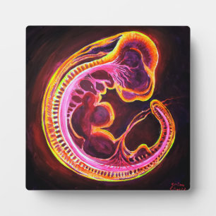 Embryo Plaque