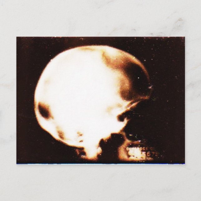 Emptyheaded Postcard (Front)