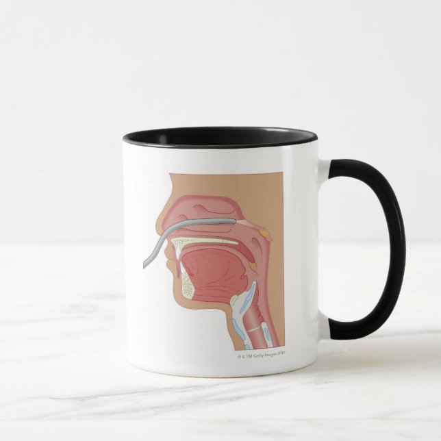 Endoscopy of the Nose Mug (Right)