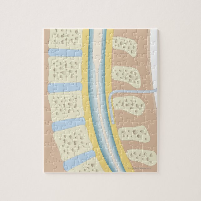 Epidural Anaesthesia Jigsaw Puzzle (Vertical)