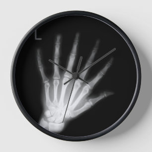 Extra Digit X-ray Left Hand Clock