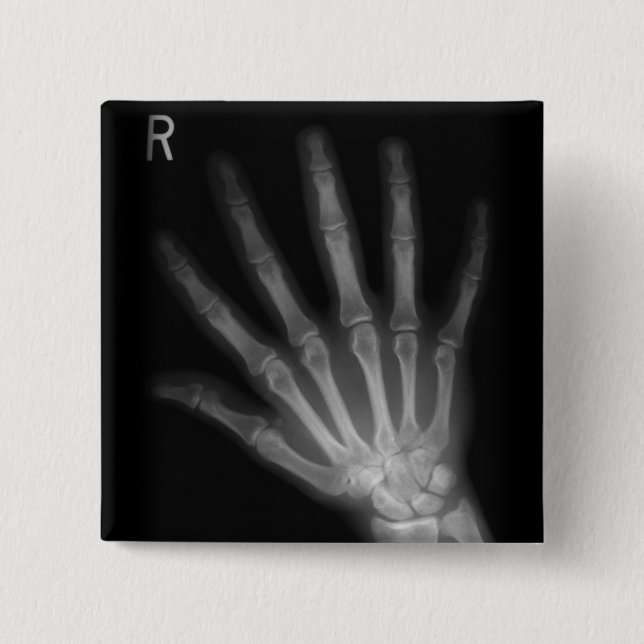 Extra Digit X-ray Right Hand 15 Cm Square Badge (Front)