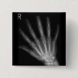 Extra Digit X-ray Right Hand 15 Cm Square Badge