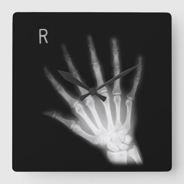 Extra Digit X-ray Right Hand Square Wall Clock (Front)