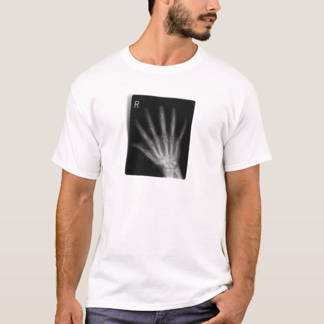 Extra Digit X-ray Right Hand T-Shirt (Front)