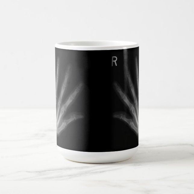 Extra Digit X-ray Right & Left Hands Coffee Mug (Center)